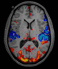 fMRI brain scan